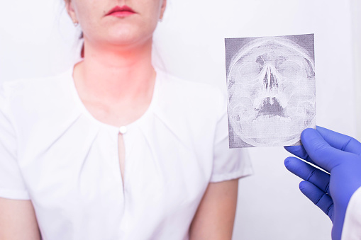Médico especialista tiene imagen de rayos X en el fondo de una niña que tiene amigdalitis de la garganta y nasofaringe, inflamación de los ganglios linfáticos photo