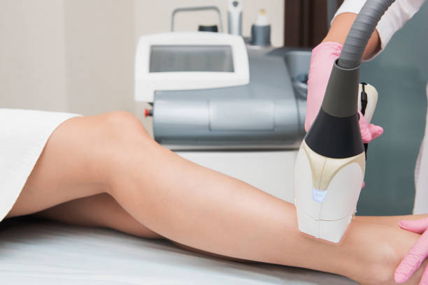 procedimiento de depilación - laser waxing human skin beauty fotografías e imágenes de stock