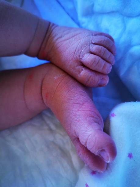 istock New born Maria legs finger 1172534095