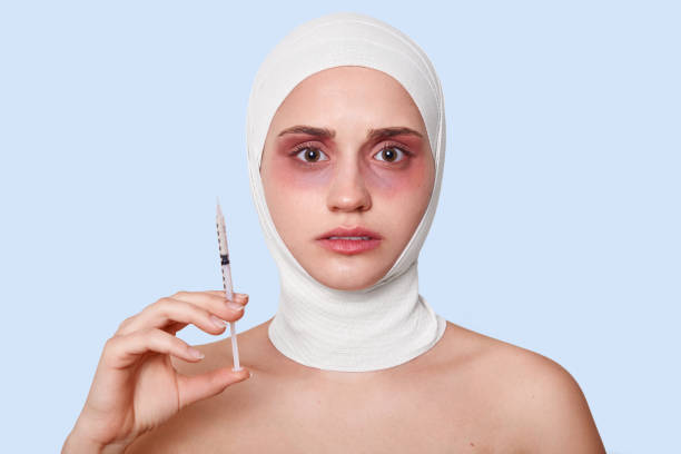 foto di giovane donna che tiene la siringa per fare la procedura di ringiovanimento del viso, femmina dopo operazione cosmetica, con lividi intorno agli occhi e benda medica, isolata su sfondo blu dello studio. - plastic surgery bandage surgery women foto e immagini stock