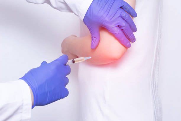 doctor makes plasma-lifting injections into the girl s inflamed joint to relieve pain and inflammation, a modern anti-inflammatory method - osteoarthritis doctor medicine healthcare and medicine imagens e fotografias de stock