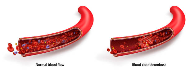 normalny przepływ krwi. skrzep krwi (skrzepliny). ilustracja wektorowa 3d izolowana na białym przezroczystym tle - healthcare and medicine human cardiovascular system anatomy human blood vessel stock illustrations