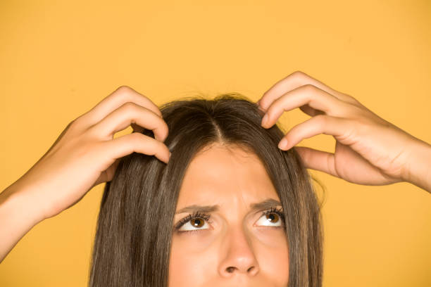 hermosa mujer joven con picazón en el cuero cabelludo sobre fondo amarillo - floyd fotografías e imágenes de stock