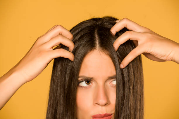 Beautiful young woman with itchy scalp on yellow background Beautiful young woman with itchy scalp on yellow background dandruff stock pictures, royalty-free photos & images