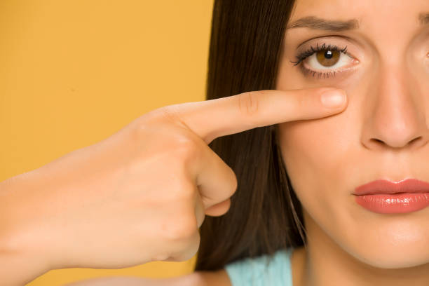 istock Young sad woman touching her  low eyelids on yellow background 1172681820