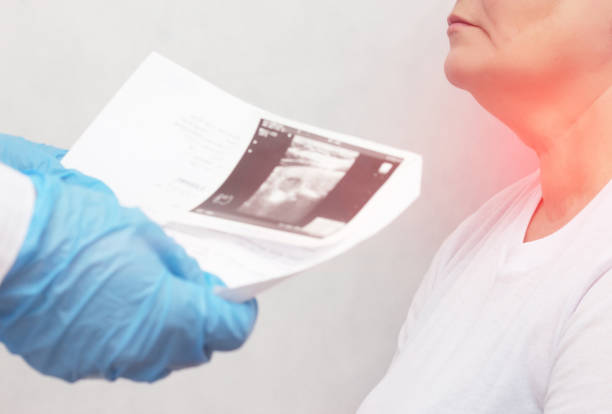 the doctor holds an ultrasound examination of the thyroid gland of an elderly woman whose nodes in the thyroid gland and a tumor - ultrasound cancer healthcare and medicine thyroid gland imagens e fotografias de stock