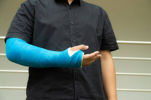 os homens asiáticos usam talas de pano em seus braços para tratar os ferimentos do acidente. - physical injury hospital cast doctor - fotografias e filmes do acervo