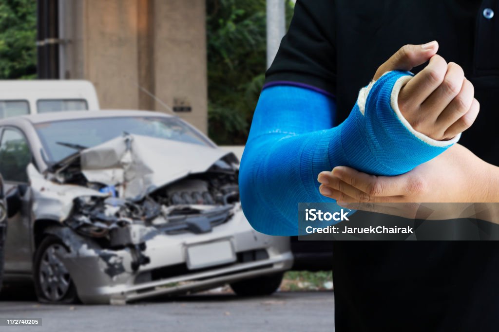 man holding hand with blue bandage as arm injury concept with car accident. Close up man holding hand with blue bandage as arm injury concept with car accident, Car Accident Stock Photo