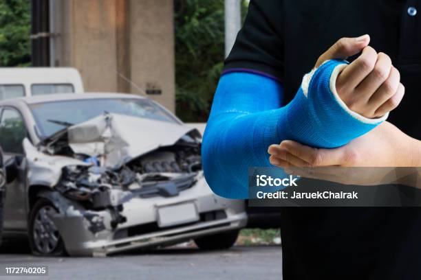 Man Holding Hand With Blue Bandage As Arm Injury Concept With Car Accident Stock Photo - Download Image Now