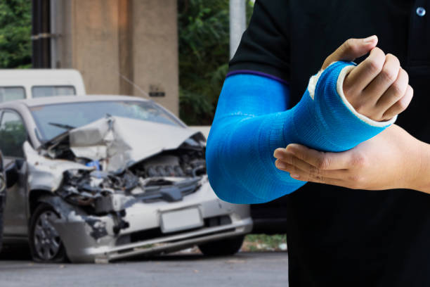 mão da terra arrendada do homem com atadura azul como o conceito de ferimento do braço com acidente de carro. - physical injury hospital cast doctor - fotografias e filmes do acervo