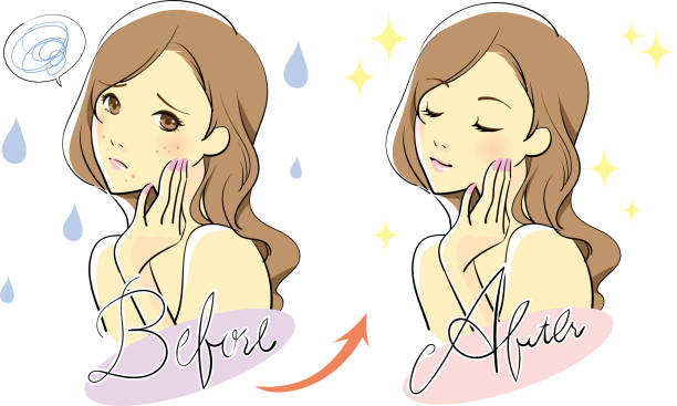 Female skin care Women who suffer from rough skin and skin care freckle stock illustrations