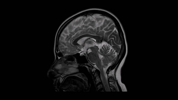 istock Brain MRI Scan of Healthy Male  (Magnetic Resonance Imaging) High Resolution 1172987283