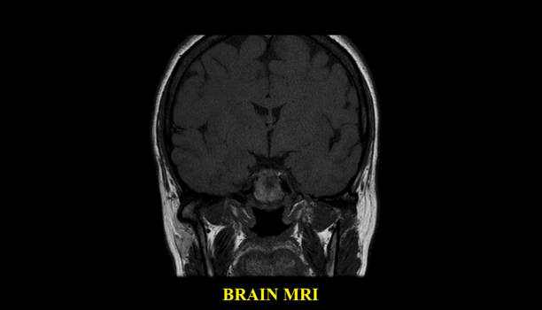 brain mri scan zdrowego mężczyzny (rezonans magnetyczny) wysoka rozdzielczość - human nervous system cat scan brain doctor zdjęcia i obrazy z banku zdjęć