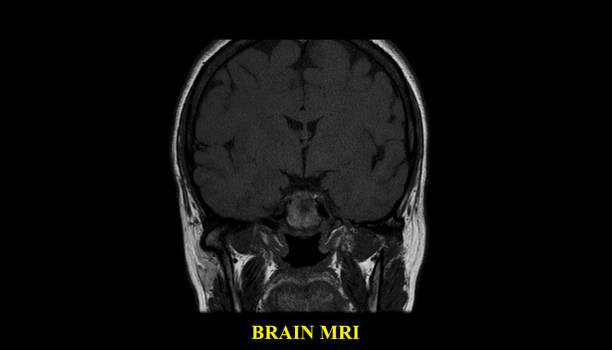 varredura do cérebro mri do macho saudável (imagem latente de ressonância magnética) de alta resolução - neuroscience mri scan brain brain surgery - fotografias e filmes do acervo