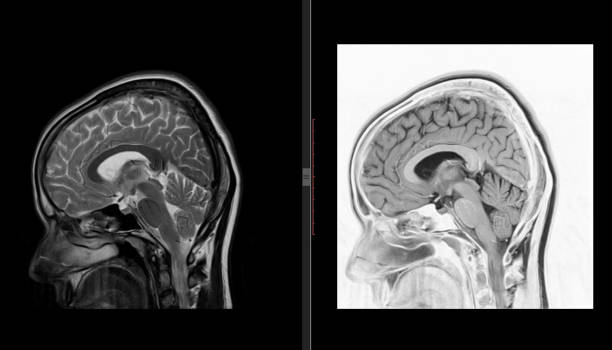 brain mri scan zdrowego mężczyzny (rezonans magnetyczny) wysoka rozdzielczość - human nervous system cat scan brain doctor zdjęcia i obrazy z banku zdjęć