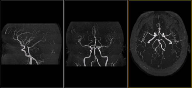brain mri scan zdrowego mężczyzny (rezonans magnetyczny) wysoka rozdzielczość - human nervous system cat scan brain doctor zdjęcia i obrazy z banku zdjęć
