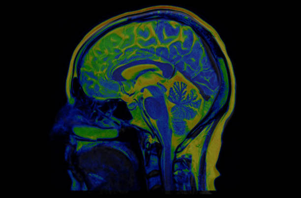 varredura do cérebro mri do macho saudável (imagem latente de ressonância magnética) de alta resolução - neuroscience mri scan brain brain surgery - fotografias e filmes do acervo