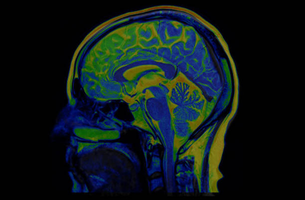 мрт головного мозга здоровых мужчин (магнитно-резонансная томография) высокого разрешения - brain mri scanner mri scan medical scan стоковые фото и изображения