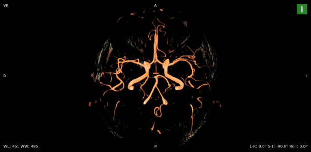 brain mri scan zdrowego m�ężczyzny (rezonans magnetyczny) wysoka rozdzielczość - human nervous system cat scan brain doctor zdjęcia i obrazy z banku zdjęć