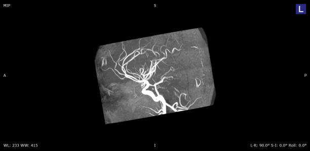 istock Brain MRI Scan of Healthy Male  ( Magnetic Resonance Imaging) High Resolution 1172992576