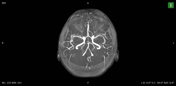 varredura do cérebro mri do macho saudável (imagem latente de ressonância magnética) de alta resolução - neuroscience mri scan brain brain surgery - fotografias e filmes do acervo