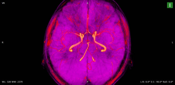 resonancia magnética cerebral de hombre sano (imágenes de resonancia magnética) de alta resolución - mri scan human nervous system brain medical scan fotografías e imágenes de stock
