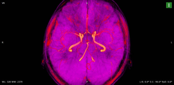 varredura do cérebro mri do macho saudável (imagem latente de ressonância magnética) de alta resolução - neuroscience mri scan brain brain surgery - fotografias e filmes do acervo