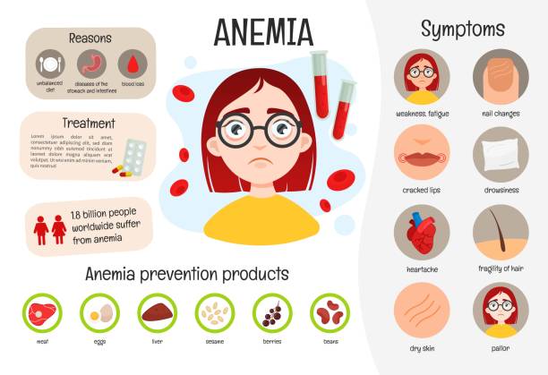 Vector medical poster anemia. Vector medical poster anemia. Symptoms of the disease. Prevention. Illustration of a cute girl. anemia stock illustrations