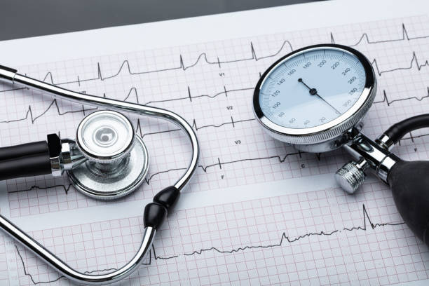 blood pressure gauge and stethoscope on cardiogram - pressure gauge audio imagens e fotografias de stock