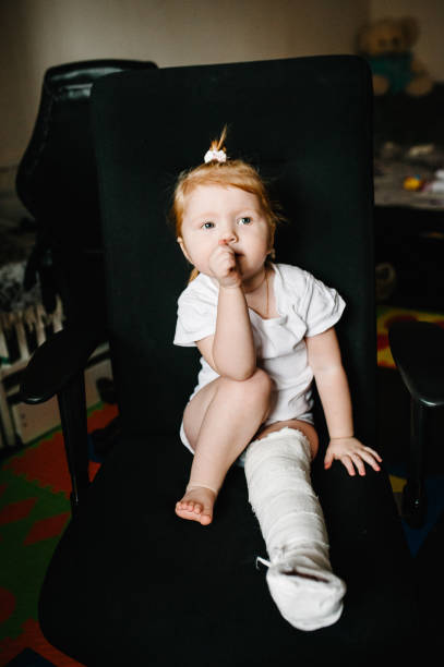 enfant avec le bandage sur la rupture de talon de jambe. pied gauche cassé, os, veau, cheville, jambe en plâtre, attelle d'enfant en bas âge. petite fille blessée s'asseyant sur la présidence à la maison. rapprocher. - physical injury bandage wound cast photos et images de collection