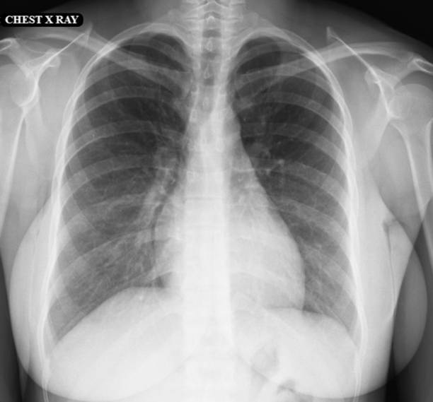 istock CT SCAN of Thorax and Abdomen (Computed Tomography- CAT) 1173159740