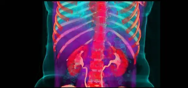 Photo of CT SCAN of Thorax and Abdomen (Computed Tomography- CAT)