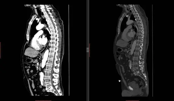Photo of CT SCAN of Thorax and Abdomen (Computed Tomography- CAT)
