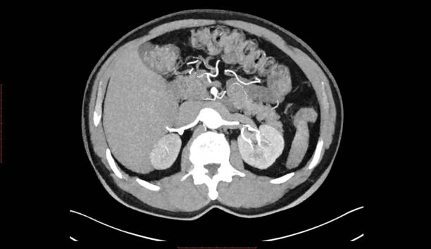 흉부와 복부의 ct 스캔 (컴퓨터 단층 촬영 - cat) - human spine mri scan x ray doctor 뉴스 사진 이미지