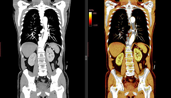 Medical Imaging and Radiology