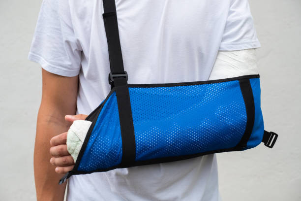 mann mit gebrochenem arm gewickelt medizinischen gegossen und blauen verband. fiberglasguss bedeckt handgelenk, arm, ellbogen nach sportunfall, isoliert auf weiß - armschlinge stock-fotos und bilder