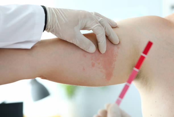 istock Pharmaceutical drugs express allergy test concept 1173223033