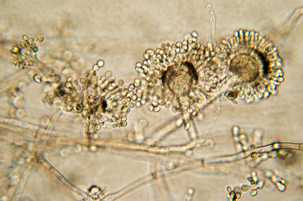 aspergillus 糸状菌アカパンカビ顕微鏡写真 - spore ストックフォトと画像