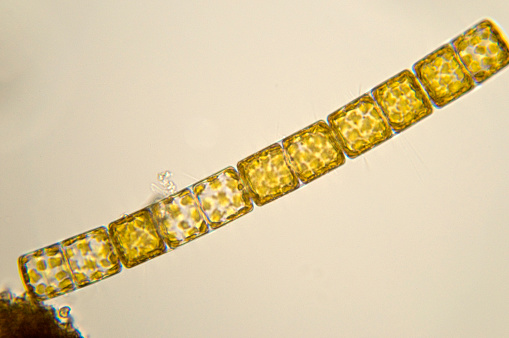 Chain or ribbon diatom, a type of algae. 