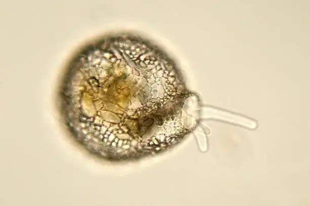 Some amoebas like this one form shells. Shell is composed of bits of rock (sand), diatom shells, and other debris. Fresh water. Live specimen. Wet mount, 40X objective, transmitted brightfield illumination.