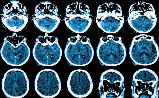 cervello umano - phase image mri scan science nobody foto e immagini stock