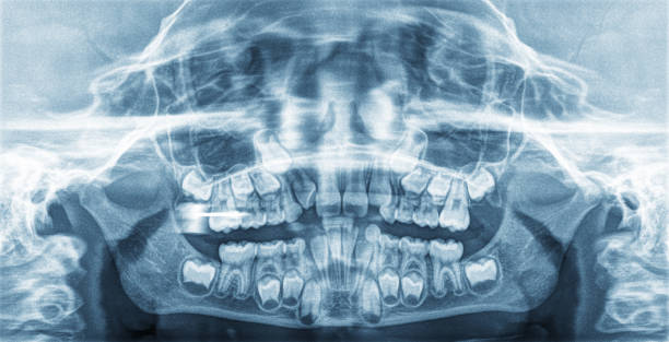 istock Panoramic X-Ray teeth of a child 1173506279