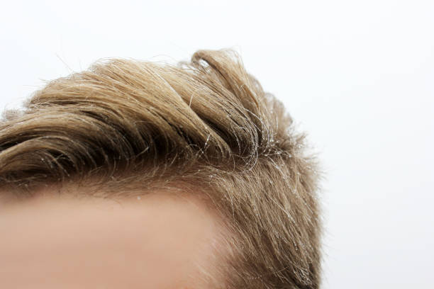 istock Hair in raindrops 1173628572
