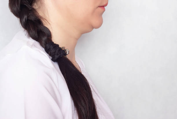 istock Beautiful girl on a white background whose problem on the face is double chin, copy space 1173748543