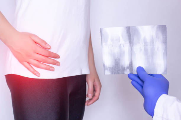 el médico sostiene una imagen de rayos x en el fondo de una niña con dolor en la articulación de la cadera y hernia intervertebral, fibromialgia, primer plano - haunch fotografías e imágenes de stock