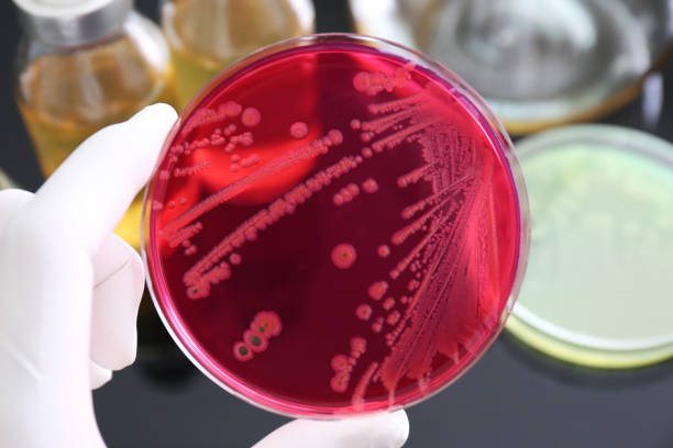 istock Salmonella was growth in (selective medium) XLD agar 1173821316