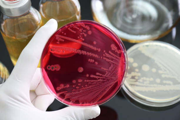 la salmonella è stata la crescita dell'agar xld (mezzo selettivo) - bacteriologist foto e immagini stock