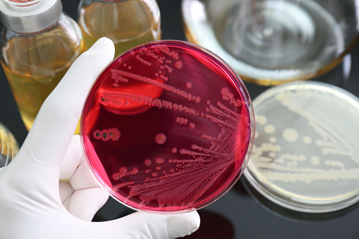 Salmonella was growth in (selective medium) XLD agar