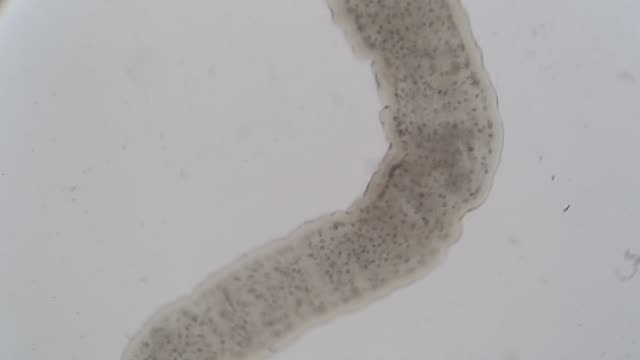 Tapeworm infection is the infestation of the digestive tract by a species of parasitic flatworm, called tapeworms under the microscope for education in Lab.