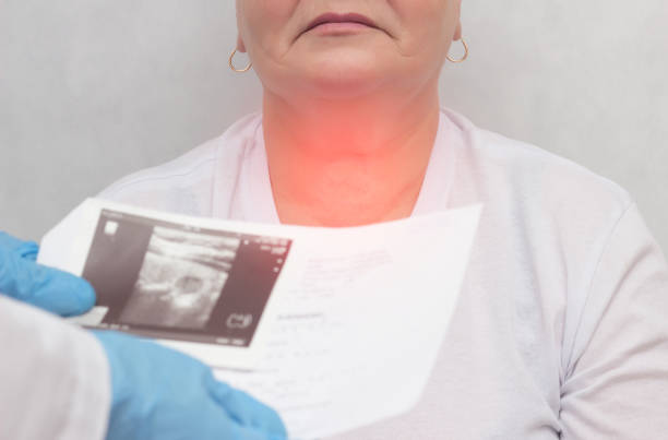 Patient at a doctor with a thyroid disease of the nodular goiter, close-up, medical, inflammation Patient at a doctor with a thyroid disease of the nodular goiter, close-up, medical, pain uzi submachine gun stock pictures, royalty-free photos & images